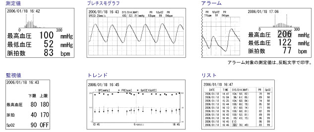 生物識別信息監(jiān)視器TM  -  2571 / TM  -  2572（重要盒）打印打印示例圖像